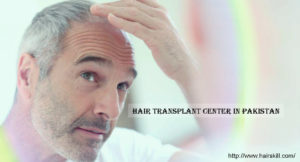 Hair Transplant Center in Pakistan